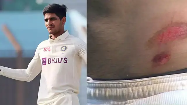 इंदौर टेस्ट में चोटिल हुए Shubman Gill, मैदान पर ही बहने लगा कमर से खून, रोहित शर्मा के उड़े होश